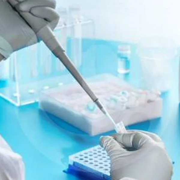 Investigan qué pasó con laboratorio de covid-19 en Caquetá: destinaron los recursos y no lo construyeron