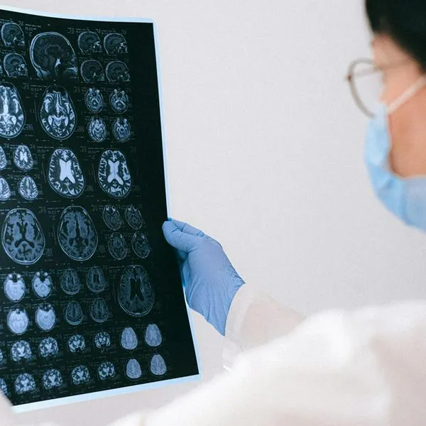 Científicos identifican un alimento natural que ayuda a tratar el Alzheimer