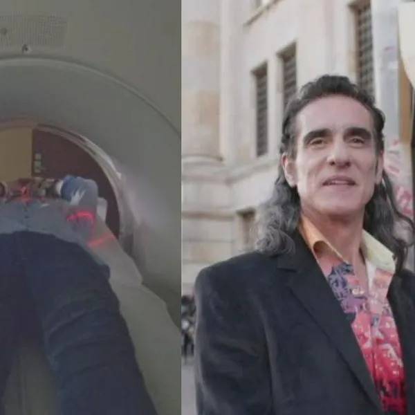 Enfermedad que tiene en riesgo a 'Pedro el escamoso' o Miguel Varoni 