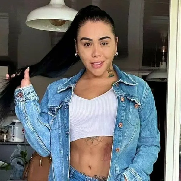 ¿Cuántas operaciones se ha hecho Yina Calderón? Esta fue la última que se ha hecho viral