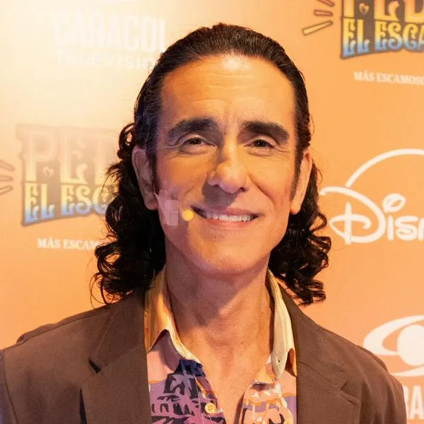 Miguel Varoni, 'Pedro, el escamoso 2' contó sobre los cambios físicos 