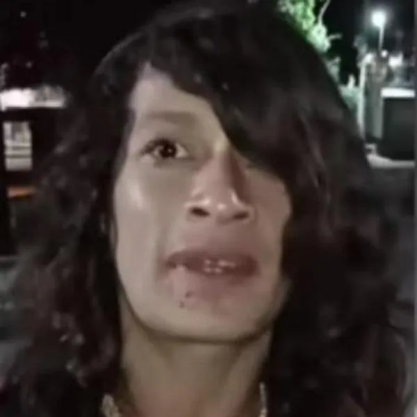 Mujer trans fue atacada brutalmente con un machete: la hirieron en el rostro y en el cuerpo