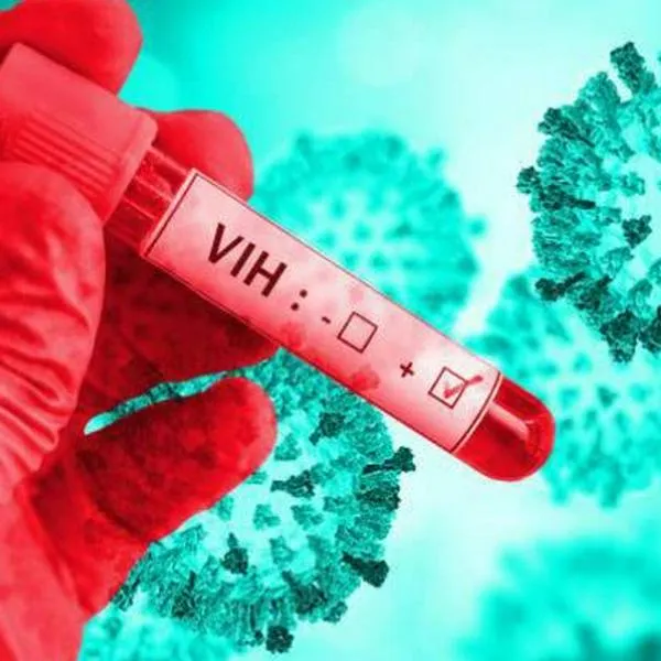 Aumentan las infecciones por VIH en América Latina, pero se reducen las muertes