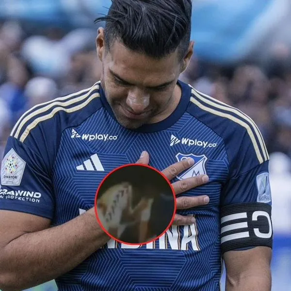 Falcao en Millonarios podría jugar en Ibagué el partido contra Patriotas por la Mundial Femenino sub 20 en Bogotá.