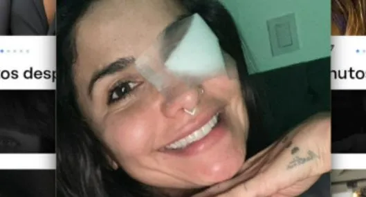 Martina, la peligrosa mostró su ojo luego de accidente en 'Masterchef Celebrity'