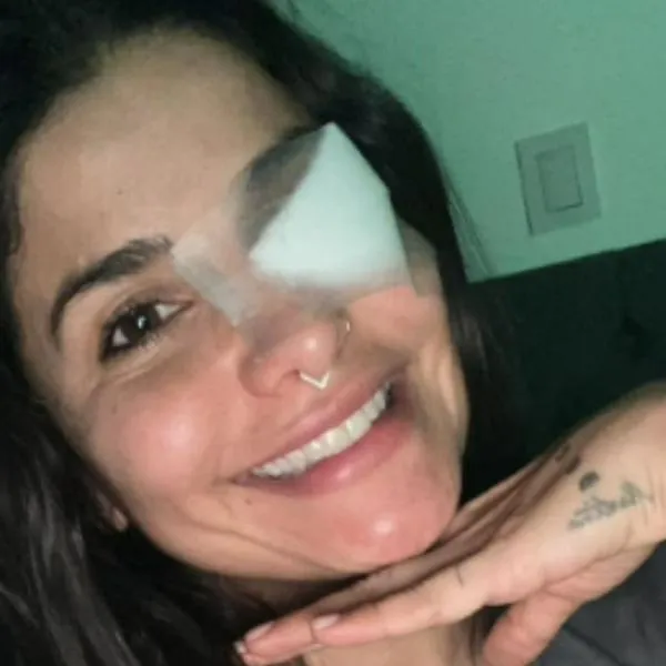 Martina, la peligrosa mostró su ojo luego de accidente en 'Masterchef Celebrity'