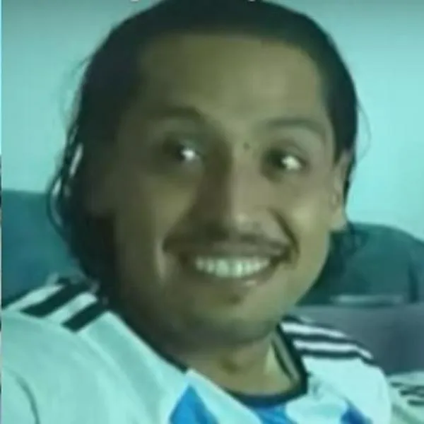 Joven despierta de coma luego de ser víctima de un brutal ataque en Bogotá