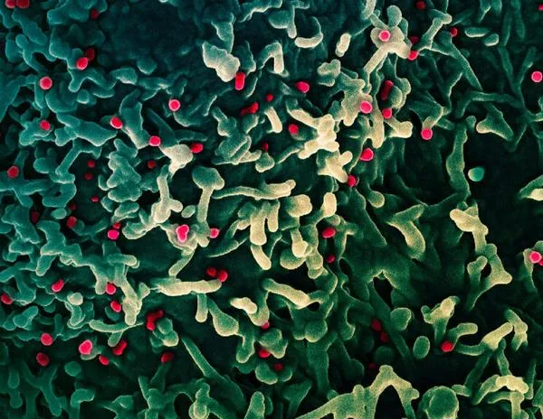 África declara alerta de salud continental por variante de la 'viruela del mono'