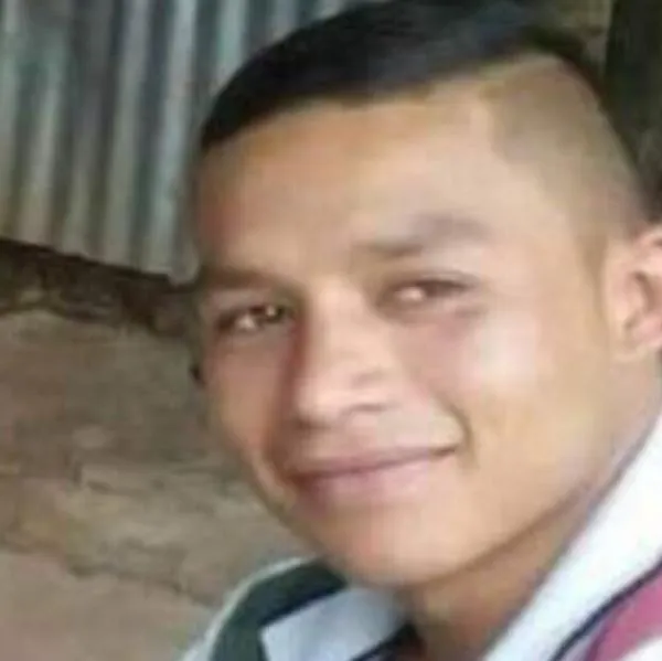 Falleció en Valledupar Investigan la muerte de joven en La Guajira que recibió disparo en el rostro