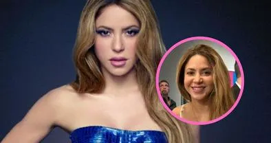 Le llueven críticas a Shakira por cambios en su cara: dicen que abusó del bótox