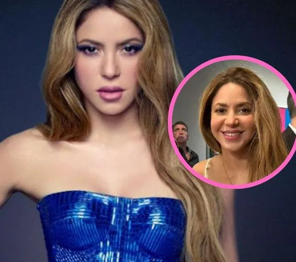 Le llueven críticas a Shakira por cambios en su cara: dicen que abusó del bótox