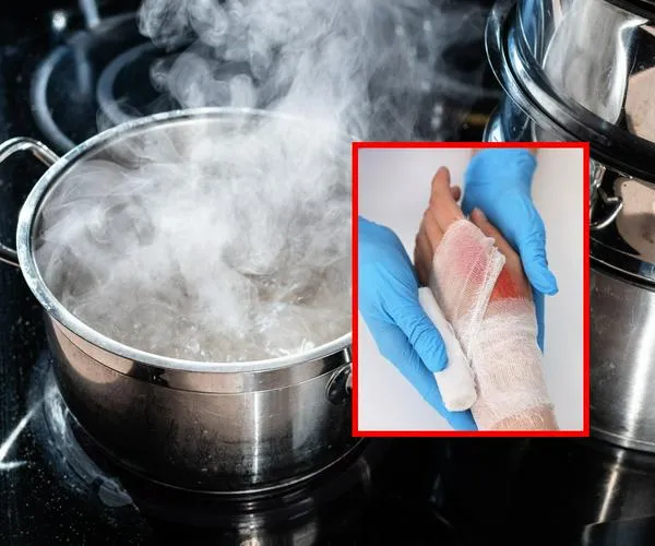 Mujer habría atacado con una sopa hirviendo a su sobrina en Turbo, Antioquia