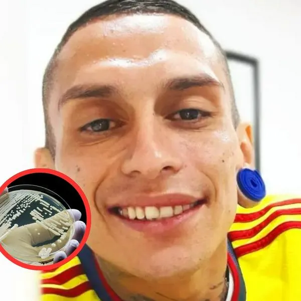 Hincha de Millonarios que tendrá eutanasia dijo cómo detectó bacteria en piscina