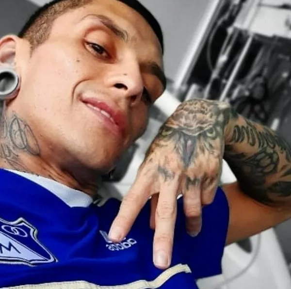 Dicen qué tan agresiva es la Candida Auris, bacteria que tuvo hincha de Millonarios y cómo tratarla. Por este hongo Javier Acosta se sometió a eutanasia.