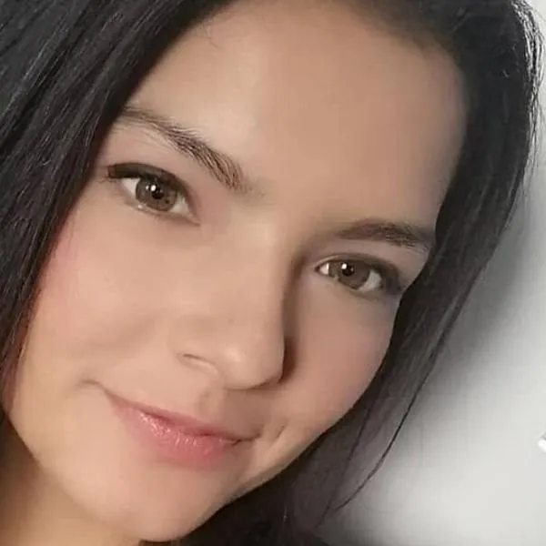 “Sin piel para ser usada como injerto”: así avanza la recuperación de Laura Villamil