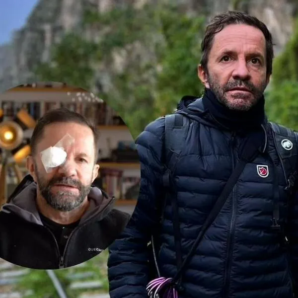 Pirry aparece en redes sociales con un parche en su ojo