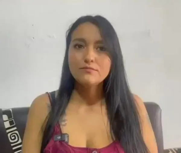 Dueña del perro pitbull habló sobre lo que pasó.