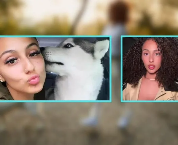 Mujer perdió ojo luego de accidente con la correa de su perro: cómo pasó
