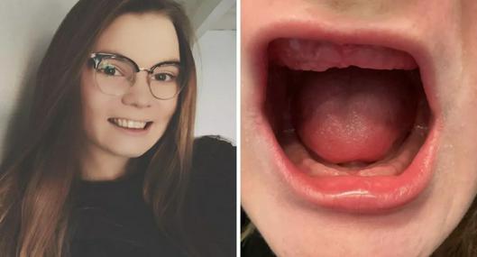 Bélgica hoy: joven perdió todos sus dientes luego de cirugía estética dental