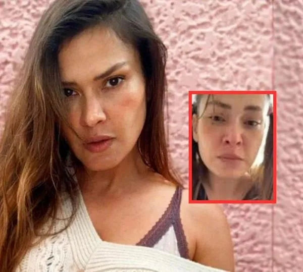 Actriz Katherine Porto relató que la intentaron robar en Bogotá y quedó herida
