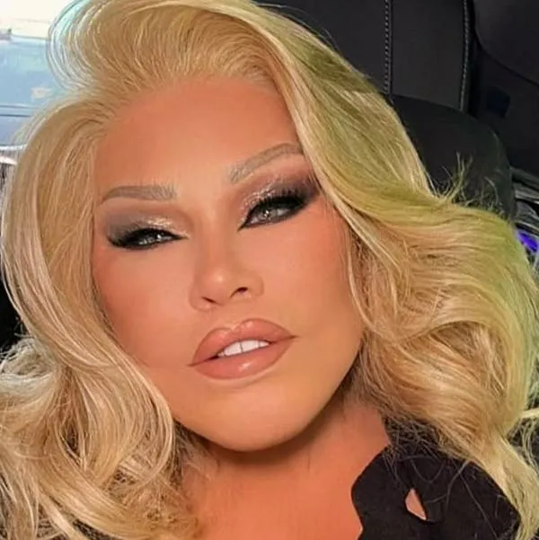 Murió 'la mujer felina', Jocelyn Wildenstei, a los 79 años en París 