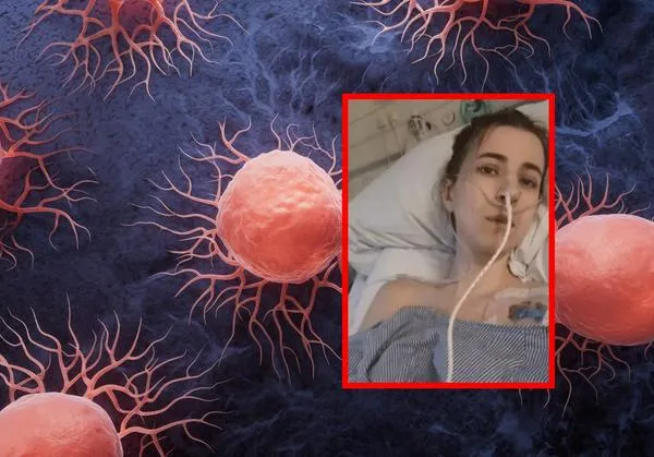 Pensó que eran cólicos y le resultaron extirpando ocho órganos por agresivo cáncer