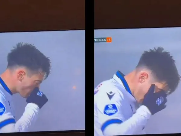 Futbolista casi pierde un ojo al sonarse la nariz durante partido: hay video