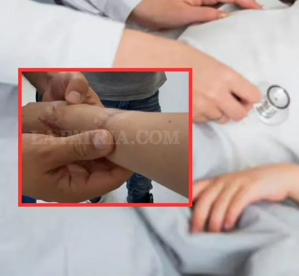 Niño que sufrió accidente de tránsito se salvó de que le amputaran la mano