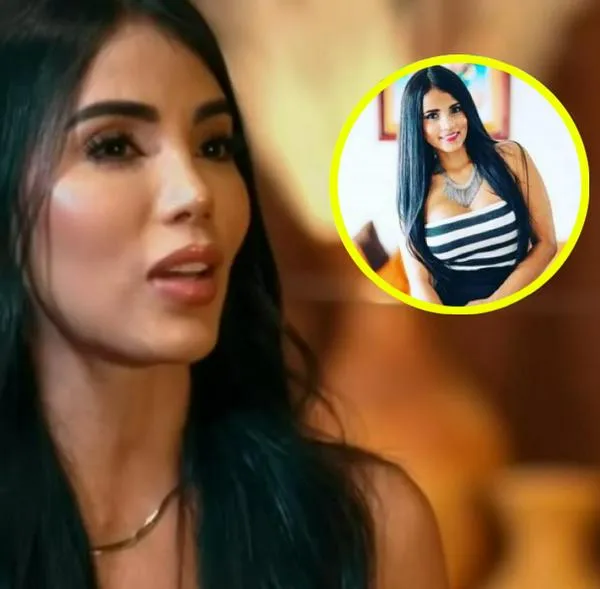 Karina García, a propósito de las cirugías que se ha hecho en su vida: detalles y demás