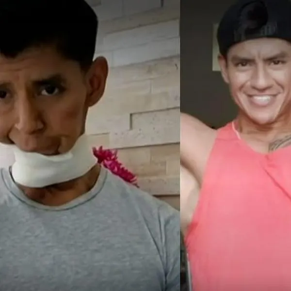 A hombre en México odontólogo le descubrió cáncer por extraña molestia en su boca: pensó que era por sus brackets