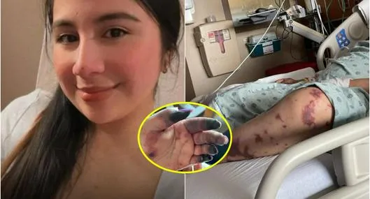 Colombiana en Estados Unidos contrajo meningitis bacteriana y familia pide visa humanitaria para verla: video