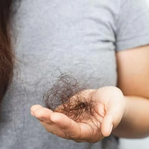 Foto de caíd de cabello, en nota sobre cuánto cabello es normal que se caiga al día y recomendaciones para no perderlo
