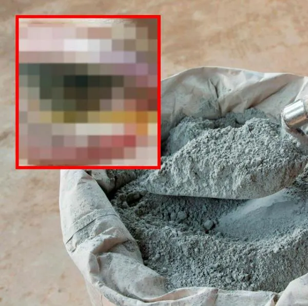 Niño en 6 años en Barrancabermeja fue quemado con cemento por su padrastro