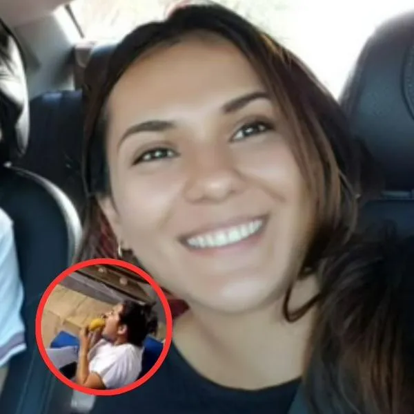 Empanada le explota en la cara a una mujer y le deja graves quemaduras