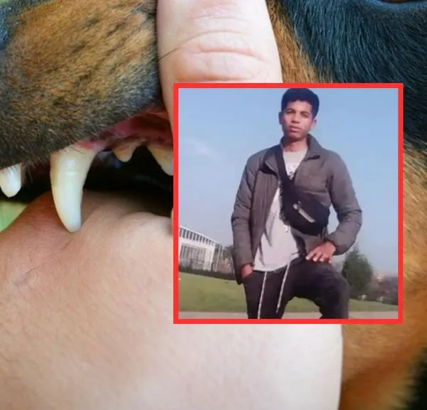 Bogotá: joven fue atacado por manada de perros, está grave y perdió los 2 brazos