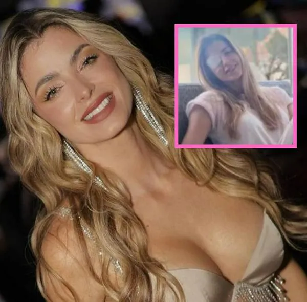 Cristina Hurtado tuvo cirugía por problema de salud y tiene ojo vendado