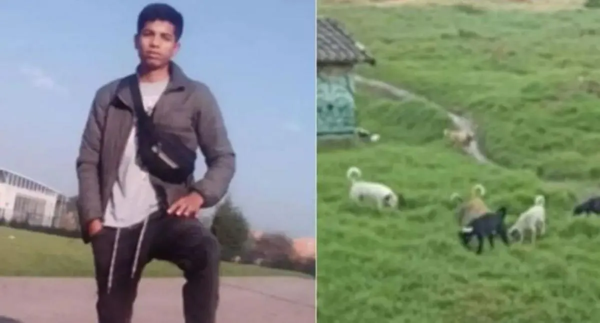 Greiber, joven que quedó sin brazos y orejas por ataque de perros en Bogotá