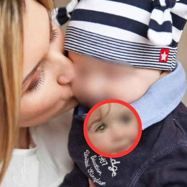 Niño de dos años quedó ciego por un beso en la mejilla. Persona tenía herpes