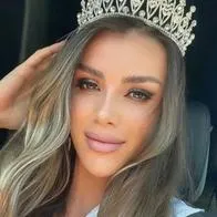 Güler Erdogan, reina de belleza que murió en Turquía, luego de caer de un puente