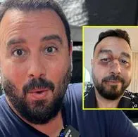 Tulio recomienda asusta con foto de golpes y era para el Burger Master 2025