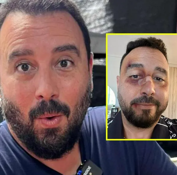Tulio recomienda asusta con foto de golpes y era para el Burger Master 2025