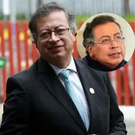 Gustavo Petro se hizo lifting que vale más de $20'000.000 para verse más joven