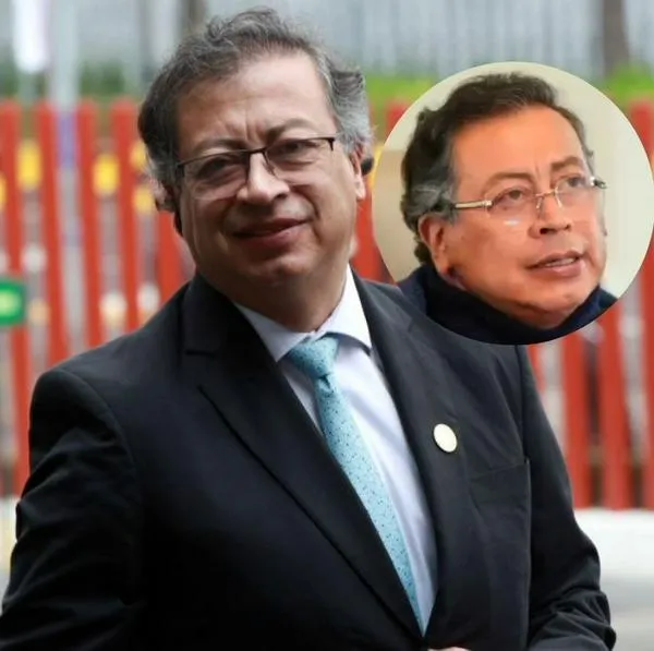 Gustavo Petro se hizo lifting que vale más de $20'000.000 para verse más joven