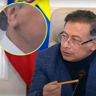 Gustavo Petro cómo quedó luego de hacerse cirugía estética, hay nuevo video