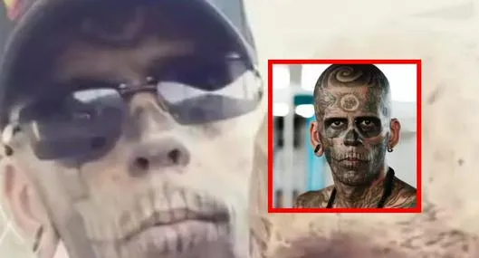 Hombre se quitó los tatuajes de la cara y así fue su doloroso proceso