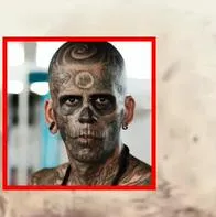 Hombre se quitó los tatuajes de la cara y así fue su doloroso proceso