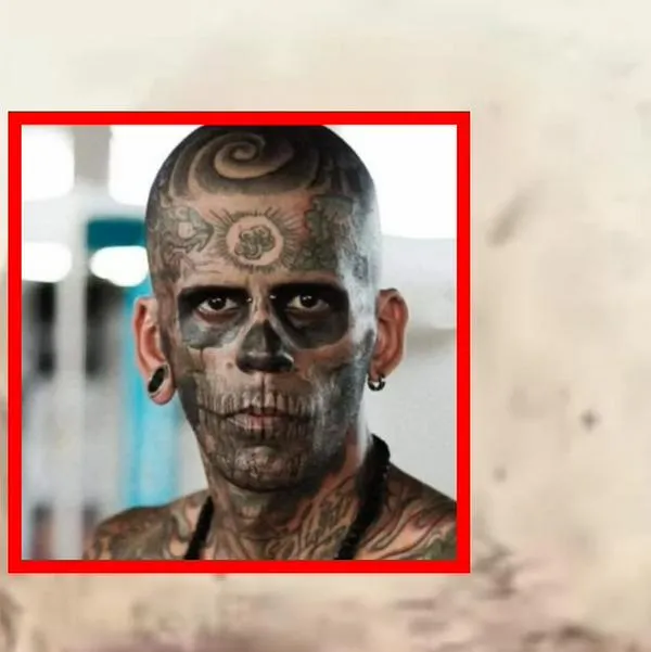 Hombre se quitó los tatuajes de la cara y así fue su doloroso proceso