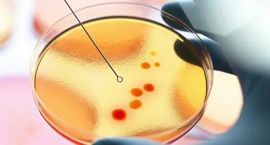 Por bacteria, varios niños fallecieron.