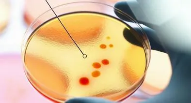 Por bacteria, varios niños fallecieron.