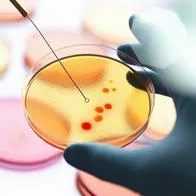 Por bacteria, varios niños fallecieron.